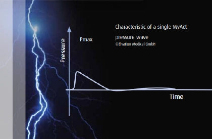 Info Chart For PiezoWave
